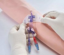 PICC与输液港是什么？